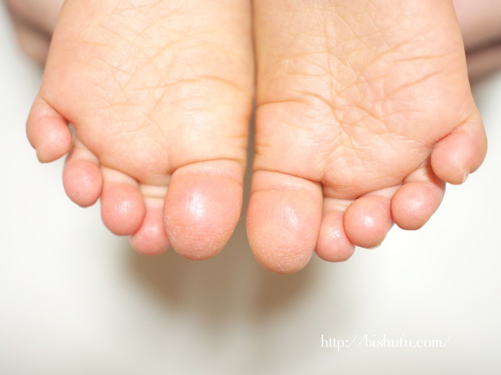赤ちゃんの乾燥してガサガサの足肌